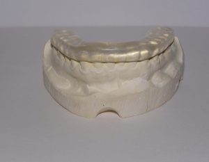 Acrylic Night Guard