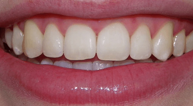 Dentist treating patient in dental chair